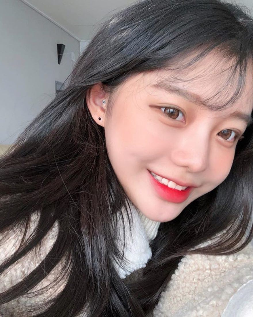 Ai cũng từng bị mụn nhưng làm sao để tránh thâm, sẹo thì bạn sẽ cần đến 5 lời khuyên tuyệt vời này từ bác sĩ-5