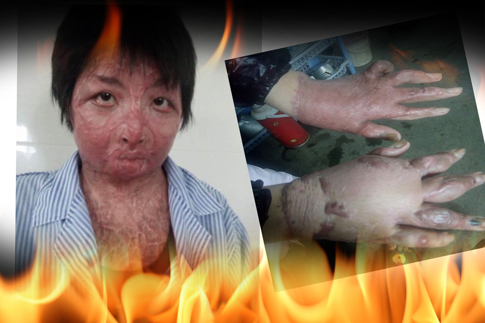 Nhan sắc và cuộc sống hiện tại của cô gái bị chồng tẩm xăng thiêu sống gây chấn động một thời ở Hưng Yên-2