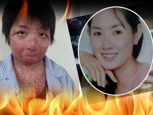 Cậu bé ở Thanh Hóa bị bố đổ xăng thiêu sống: Em ước mơ làm lính cứu hoả-5