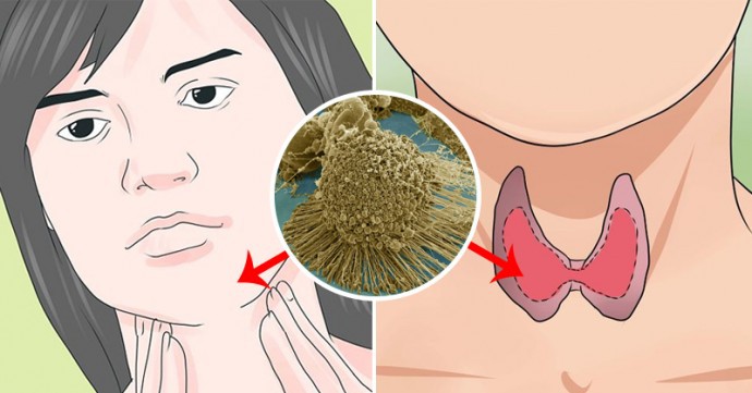 Ăn ít mà vẫn tăng cân vù vù, nguyên nhân có thể là do bạn đang gặp phải những vấn đề sức khỏe sau-3