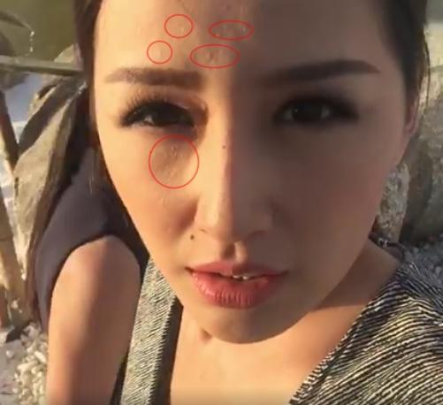 Tiểu Vy, Mai Phương Thuý và loạt mỹ nhân dù make-up kỹ càng vẫn lộ làn da chi chít mụn-2
