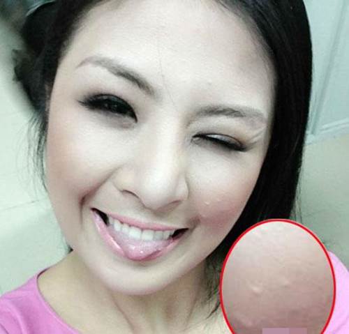 Tiểu Vy, Mai Phương Thuý và loạt mỹ nhân dù make-up kỹ càng vẫn lộ làn da chi chít mụn-3