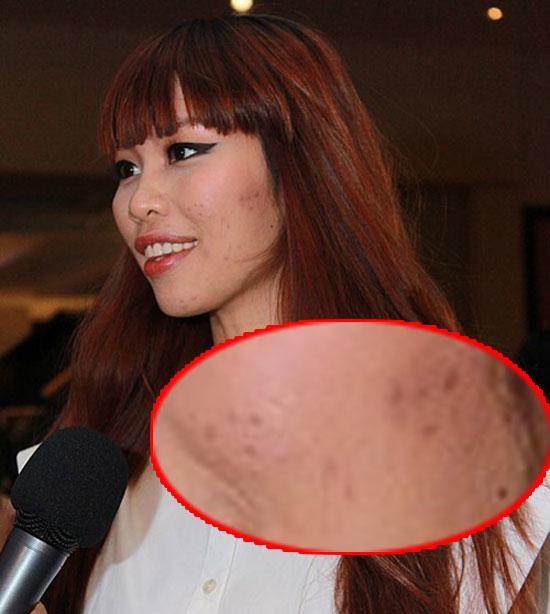 Tiểu Vy, Mai Phương Thuý và loạt mỹ nhân dù make-up kỹ càng vẫn lộ làn da chi chít mụn-8