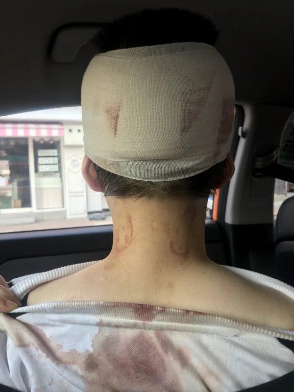 Hàn Quốc: 2 cô gái trẻ bị 4 người đàn ông tấn công chỉ vì vẻ ngoài thiếu nữ tính và để tóc ngắn, người dân bức xúc yêu cầu Nhà Xanh vào cuộc-3