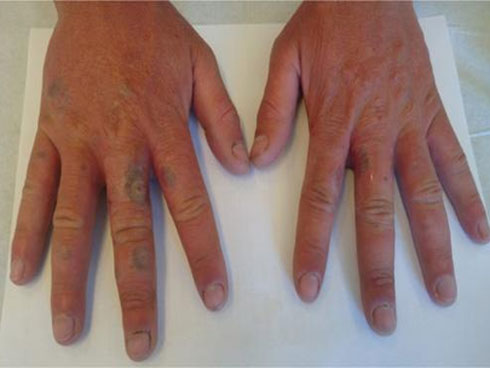 Nước chanh uống cùng thứ này thành thần dược chữa đủ bệnh cho cơ thể-6