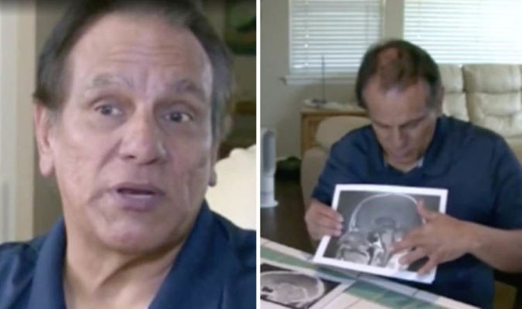 Mỹ: Người đàn ông thấp thỏm chuẩn bị phẫu thuật u não, trước ngày lên bàn mổ, khối u sợ quá biến mất luôn-3