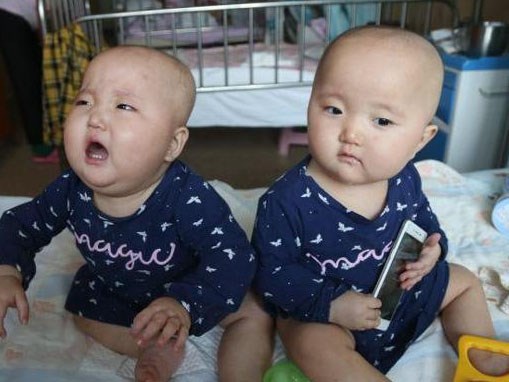 Hai con sinh đôi 11 tháng bị ung thư, mẹ chua xót khi nghe câu: 
