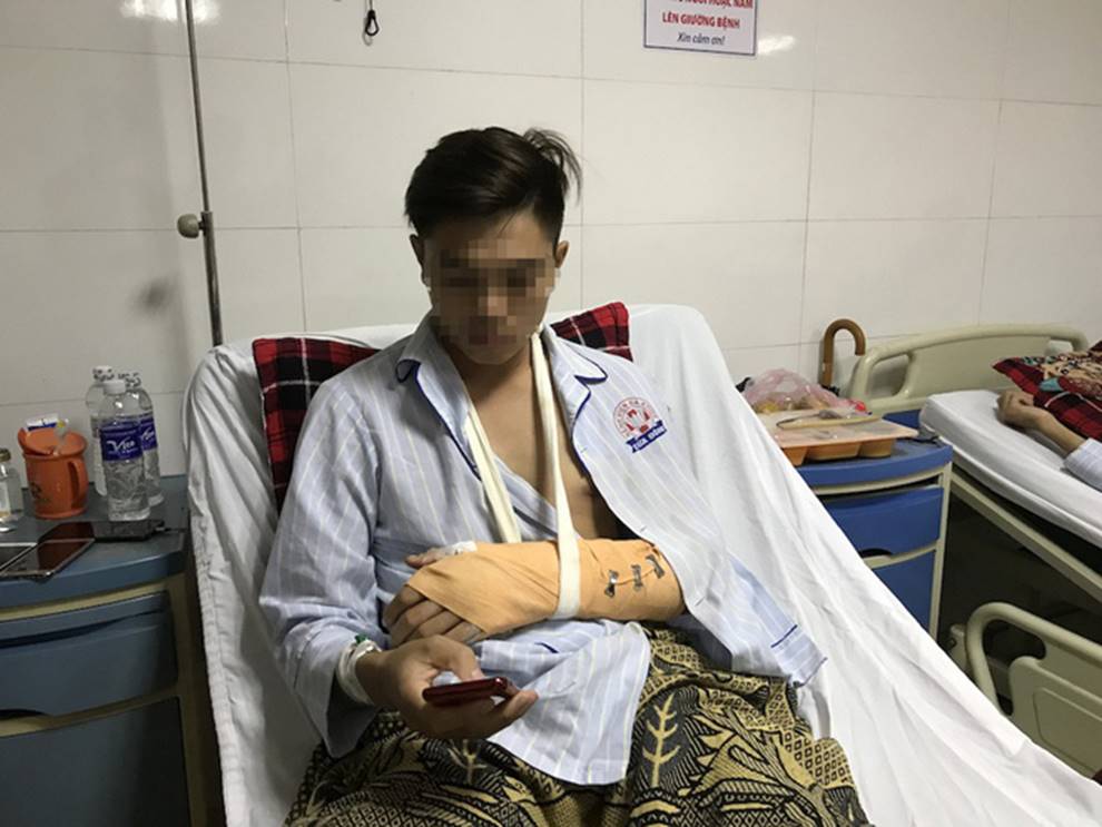 Vụ người đi xe máy chặt tay tài xế ô tô: Lộ diện hình ảnh hung thủ-2