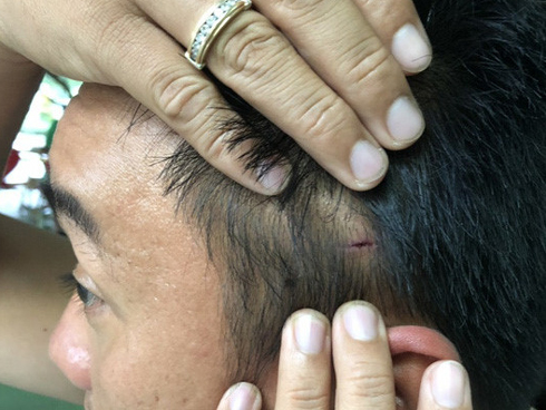 Hành trình 48 giờ truy bắt gã thanh niên đâm cô gái, cướp tài sản vì lên cơn thèm ma túy-3