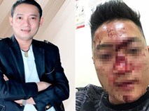 Lo lắng Chiến Thắng bị sàm sỡ, các vệ sĩ đánh "nát mặt" khán giả? Lo lắng Chiến Thắng bị sàm sỡ, các vệ sĩ đánh "nát mặt" khán giả?