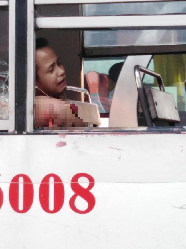 Thanh niên đau đớn mất cánh tay chỉ vì thói quen mà rất nhiều người mắc phải khi đi xe buýt-1