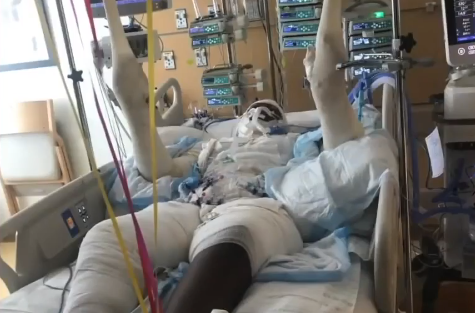 Tự thiêu để câu like trên MXH, nhiều thanh thiếu niên Mỹ nhập viện trong tình trạng nguy kịch-1