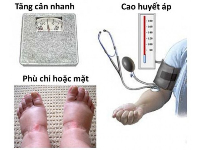 Tưởng đau bụng do bị bệnh dạ dày, mẹ không ngờ lại là hội chứng nguy hiểm khiến con gái ra đời sớm 2 tháng-10