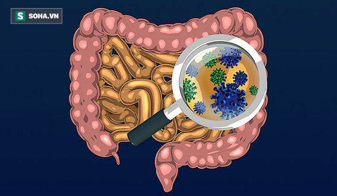 Ruột có sạch thì cơ thể mới khỏe: 7 thực phẩm giúp thải độc ruột hiệu quả ai cũng nên ăn-1