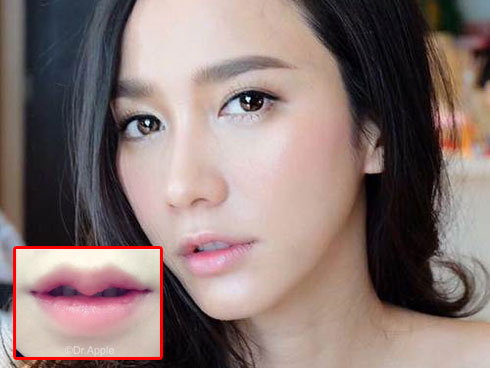 Kỳ Duyên, Bảo Thy, Lan Khuê môi càng dày, nhan sắc, sự nghiệp... càng lên hương-19