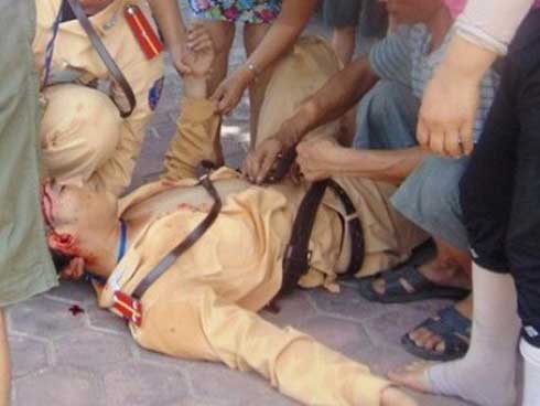 Cãi nhau với vợ, nam thanh niên tẩm xăng, ôm vợ tự thiêu-2