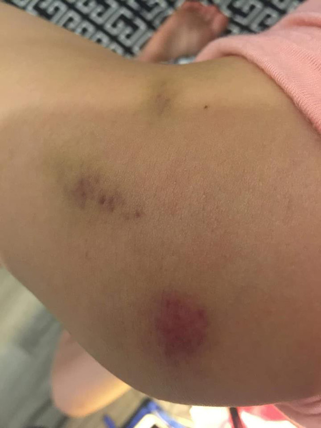 Hai vợ chồng chủ căn hộ 5 sao ở Hà Nội tố bị trưởng ban quản trị tòa nhà hành hung nhập viện-3