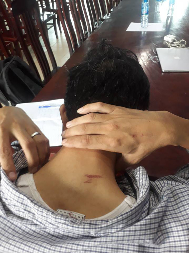 Hai vợ chồng chủ căn hộ 5 sao ở Hà Nội tố bị trưởng ban quản trị tòa nhà hành hung nhập viện-4