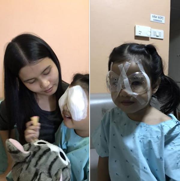 Hành động sai lầm của cha khi cho con ăn cơm khiến bé gái 4 tuổi phải phẫu thuật mắt-2