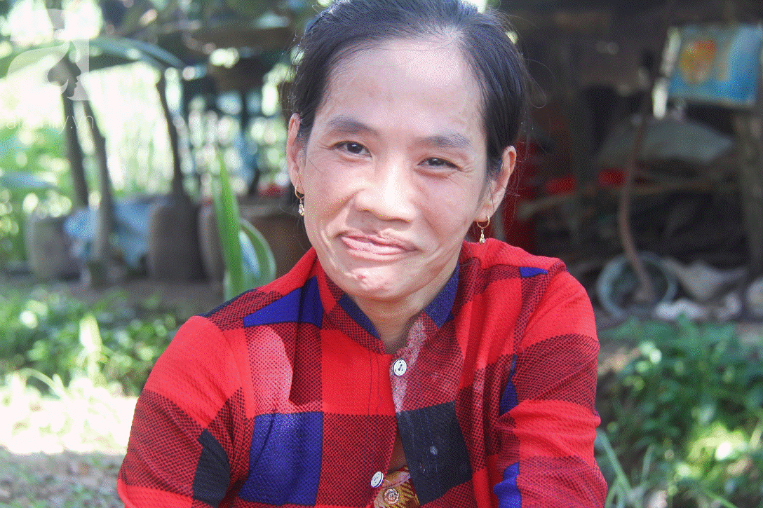 Bố bỏ từ khi chưa sinh ra, bé gái 5 tuổi bại não sống cùng người mẹ tật nguyền cầu xin một lần được chữa bệnh-15