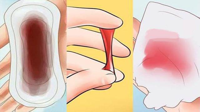 Cô gái 20 tuổi bị ung thư cổ tử cung, chỉ vì thường xuyên dùng giấy vệ sinh kiểu này-4