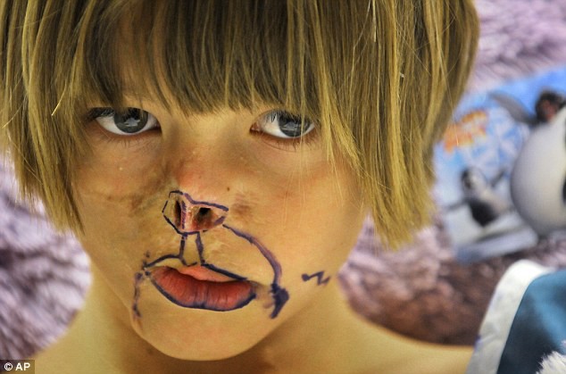 Sự thay đổi ngoạn mục của bé gái bị chồn ăn nửa mặt và ước mơ nhỏ thành hiện thực sau 15 năm-8