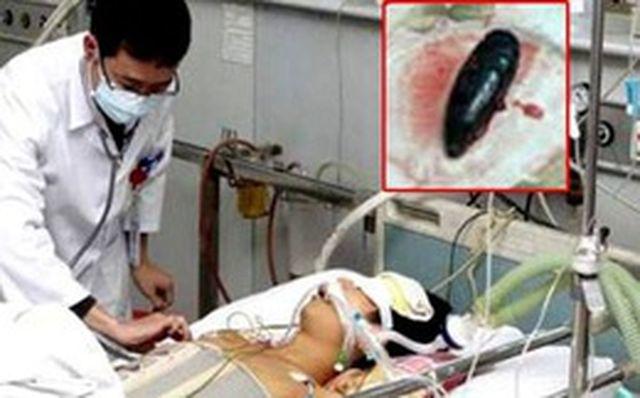 Bị suy đa tạng nghiêm trọng vì ăn phần cực nguy hiểm của cá, nhiều người cũng thích ăn nó-1