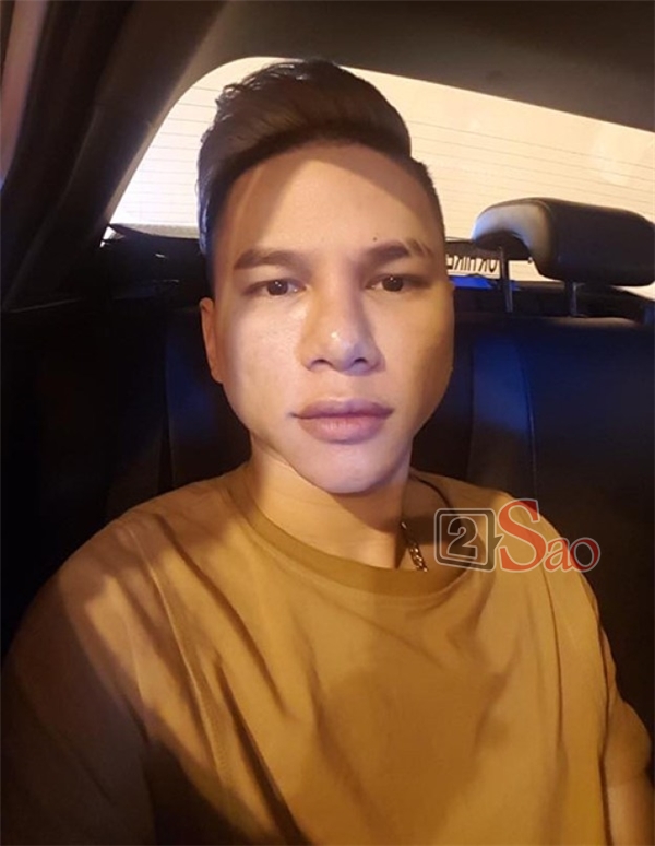 Trấn Thành khoe tóc mới nhưng fan lại khuyên đi sửa lại mũi vì nhìn lệch quá lệch-7