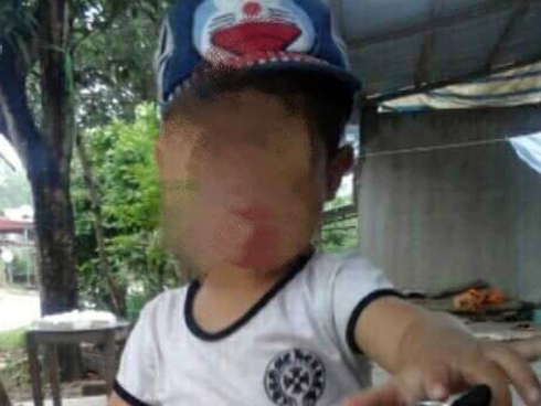 Tử vong do cắt amidan, trường hợp nào tuyệt đối không được cắt?-2