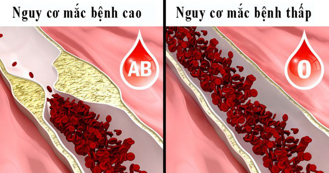 8 điều người nhóm máu O nên biết-6
