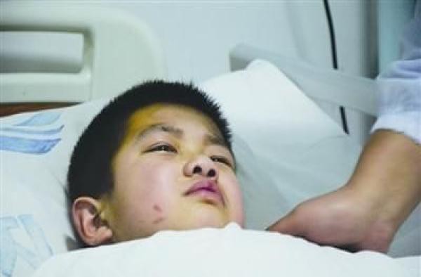 Cậu bé 7 tuổi bị ung thư gan giai đoạn cuối, nguyên nhân do chất độc có trong bếp hầu hết mọi gia đình-1