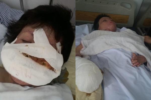 Hồi sinh từ cõi chết, mẹ 9x xinh đẹp bị chồng thiêu sống giờ khao khát kiếm tiền nuôi con-3