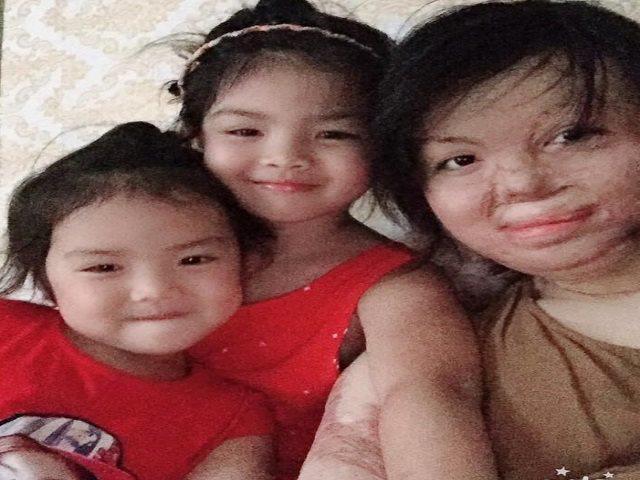 Hồi sinh từ cõi chết, mẹ 9x xinh đẹp bị chồng thiêu sống giờ khao khát kiếm tiền nuôi con-8