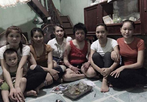 Hồi sinh từ cõi chết, mẹ 9x xinh đẹp bị chồng thiêu sống giờ khao khát kiếm tiền nuôi con-9