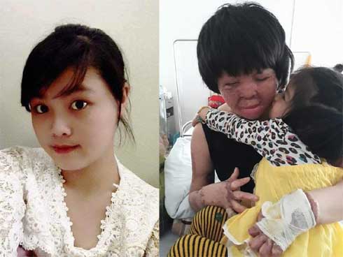 Cô gái trẻ bị chồng tưới xăng thiêu sống và lá thư muộn màng từ trại giam: Gần 3 năm anh chưa một lần dám viết thư cho em và hai con...-14