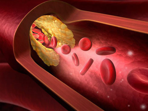 Một bác sĩ trẻ bị đột tử, nguyên nhân là bởi mắc phải thói quen mà hàng triệu người đang làm mỗi ngày-5