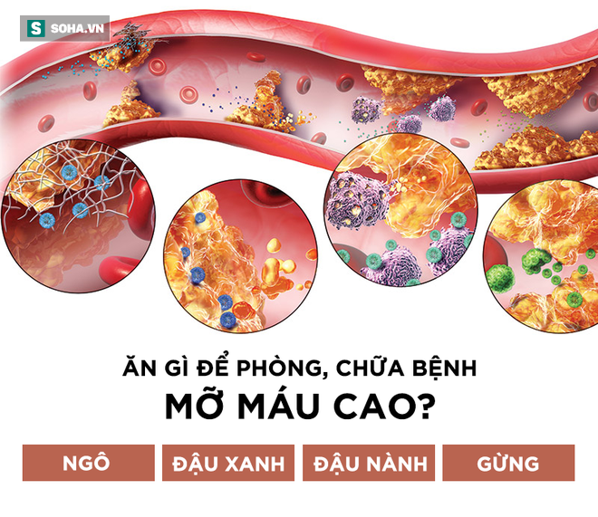 Không chỉ người béo, gầy cũng có thể bị mỡ máu cao: 6 thực phẩm nên ăn để tiêu mỡ nhanh-1