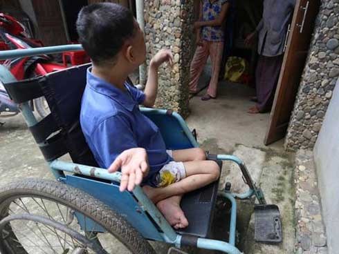 Cô gái bại liệt, nặng 20 kg bất ngờ mang thai
