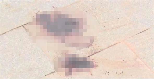 Thấy cục máu đông rơi ra, cô gái tưởng kinh nguyệt nhưng sự thật khiến ai cũng bàng hoàng-2