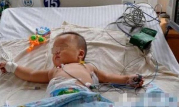 Em bé 1 tuổi bị suy thận do thói quen nấu nướng sai lầm của mẹ-1