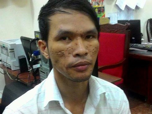 Kẻ hành hạ bé trai Campuchia bằng roi điện được tại ngoại