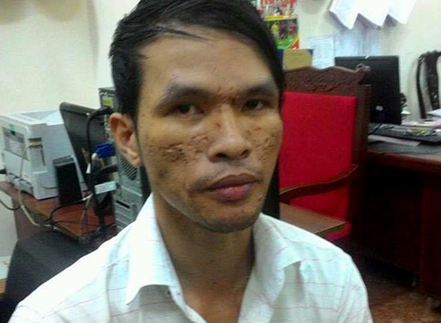 Kẻ hành hạ bé trai Campuchia bằng roi điện được tại ngoại-1