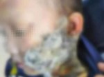 Bé gái 7 tuổi bỏng nặng vì mẹ đổ nước sôi vào người, hé lộ bi kịch gia đình-4