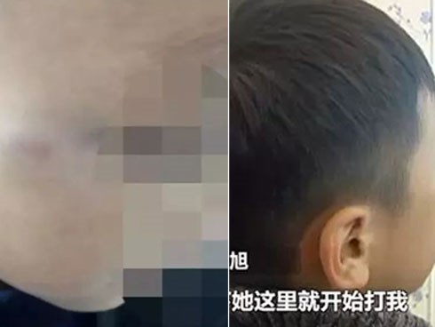 Cậu bé 7 tuổi bị cô giáo đánh vì sờ ngực, trong khi bố mẹ phẫn nộ thì phản ứng của cư dân mạng khiến ai cũng bất ngờ
