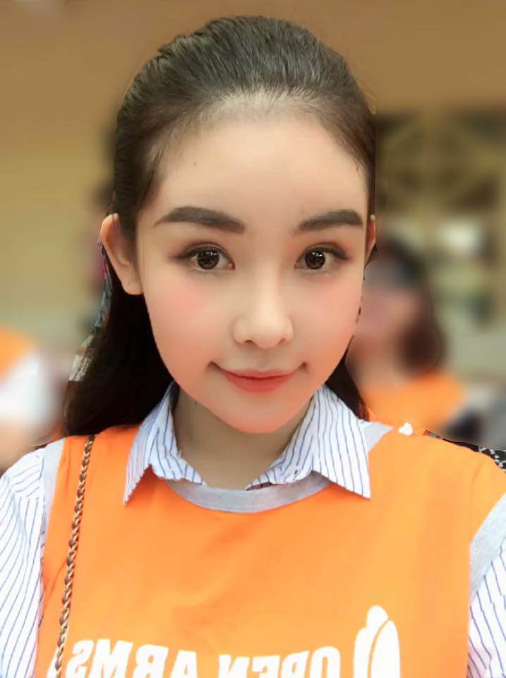 Lên tiếng trước nghi vấn bơm mặt, hoa hậu Lê Âu Ngân Anh khi nào thì mới hết thị phi?-6