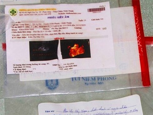 Thai phụ 29 tuổi ở Ninh Thuận tử vong khi đi phá thai chui: Bộ Y tế vào cuộc