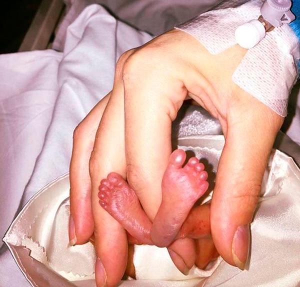 Sinh con ở tuần 22, mẹ bất lực nhìn con lịm dần vì bác sĩ dửng dưng-2
