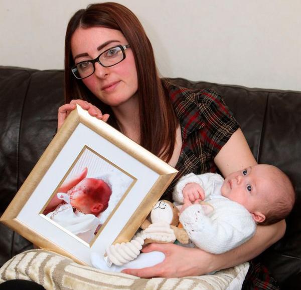Sinh con ở tuần 22, mẹ bất lực nhìn con lịm dần vì bác sĩ dửng dưng-3