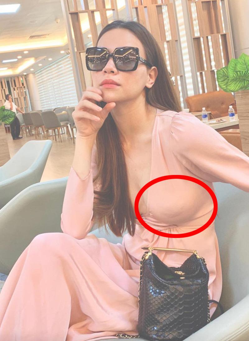 Miếng dán ngực: nỗi ám ảnh kinh hoàng đối với Hồ Ngọc Hà, Ngọc Trinh, Phí Phương Anh-2