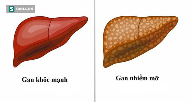 Gan phải làm việc rất nặng nhọc mỗi ngày, đây là cách chăm sóc hiệu quả ai cũng nên làm-2